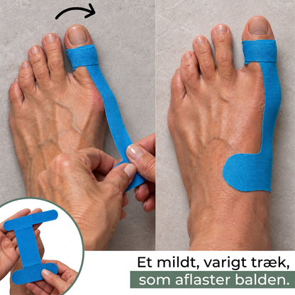 LedFlex™ Knyst – Støttetape til Hallux Valgus